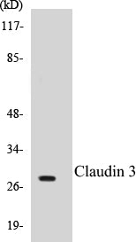 Western blot analysis of extracts from COLO205 cells, treated with EGF 200ng/ml 30', using Claudin 3 (Ab-219) Antibody.