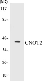 Western blot analysis of extracts from HepG2 cells, treated with starved 24h, using CNOT2 (Ab-101) Antibody.