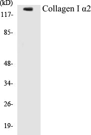 Western blot analysis of the lysates from 293 cells using Collagen I α2 antibody.