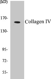 Western blot analysis of extracts from HeLa cells, using Collagen IV Antibody.