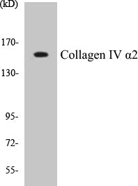 Western blot analysis of extracts from Jurkat cells, using Collagen IV alpha2 Antibody.