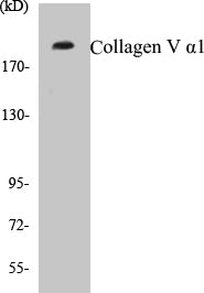 Western blot analysis of the lysates from HUVECcells using Collagen V α1 antibody.