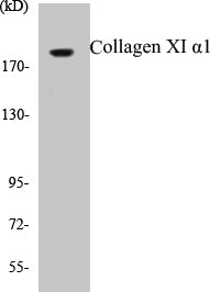 Western blot analysis of extracts from K562 cells, using Collagen XI alpha1 Antibody.