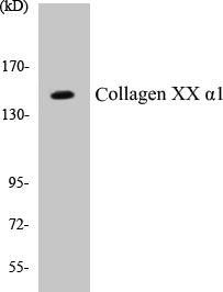 Western blot analysis of extracts from LOVO/HT-19 cells, using Collagen XX alpha1 Antibody.