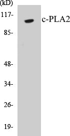 Western blot analysis of extracts from HeLa cells, treated with TNF-a 20ng/ml 30', using c-PLA2 (Ab-505) Antibody.