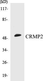 Western blot analysis of extracts from HT-29 cells, treated with heat shock, using CRMP-2 (Ab-509) Antibody.