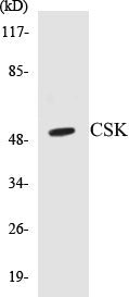 Western blot analysis of extracts from Raw264.7 cells, treated with UV 5', using CSK (Ab-364) Antibody.