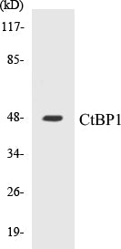 Western blot analysis of extracts from Jurkat cells, using CtBP1 (Ab-422) Antibody.