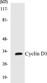 Western blot analysis of extracts from Jurkat cells, treated with EGF 200ng/ml 30', using Cyclin D1 (Ab-286) Antibody.