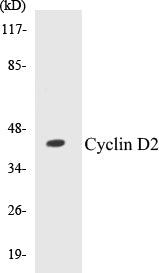Western blot analysis of extracts from 293 cells, using Cyclin D2 (Ab-280) Antibody.