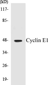 Western blot analysis of extracts from HeLa cells, treated with Paclitaxel 1uM 60', using Cyclin E1 (Ab-395) Antibody.