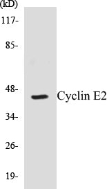 Western blot analysis of extracts from COLO/Jurkat cells, using Cyclin E2 (Ab-392) Antibody.