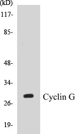 Western blot analysis of extracts from Jurkat cells, using Cyclin G Antibody.
