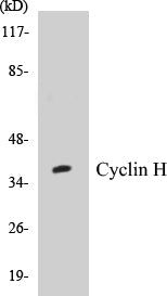Western blot analysis of extracts from HepG2/LOVO/RAW264.7 cells, using Cyclin H (Ab-315) Antibody.