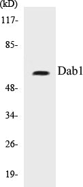Western blot analysis of extracts from HepG2/293 cells, using Dab1 (Ab-232) Antibody.
