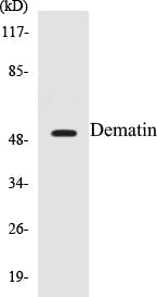 Western blot analysis of extracts from 293 cells, using Dematin (Ab-403) Antibody.