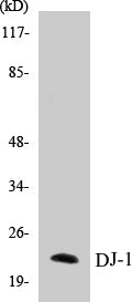 Western blot analysis of the lysates from HUVECcells using PARK7 antibody.