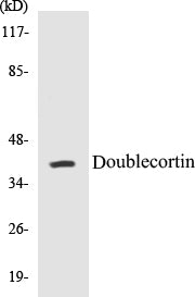 Western blot analysis of extracts from Jurkat cells, using Doublecortin (Ab-376) Antibody.