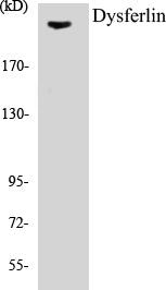 Western blot analysis of extracts from K562 cells, using Dysferlin Antibody.