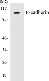 Western blot analysis of extracts from 293 cells, using E-cadherin Antibody.