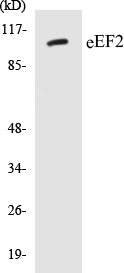 Western blot analysis of extracts from NIH-3T3 cells, treated with serum 10% 30', using eEF2 (Ab-56) Antibody.