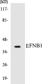 Western blot analysis of extracts from COS7 cells, using EFNB1 (Ab-317) Antibody.