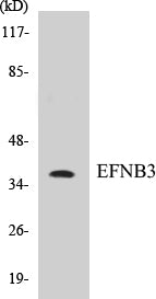 Western blot analysis of extracts from SKOV3 cells, using EFNB3 Antibody.