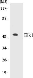 Western blot analysis of extracts from JurKat cells, using Elk1 (Ab-383) Antibody.