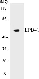 Western blot analysis of extracts from HepG2 cells treated with PMA 125ng/ml 30', using EPB41 (Ab-660/418) Antibody.