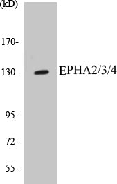 Western blot analysis of extracts from MCF-7 cells, using EPHA2/3/4 (Ab-588/596) Antibody.