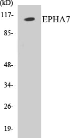 Western blot analysis of extracts from Jurkat cells/COLO205 cells, using EPHA7 Antibody.