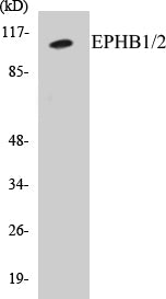 Western blot analysis of extracts from HepG2 cells, using EPHB1/2 (Ab-594/604) Antibody.