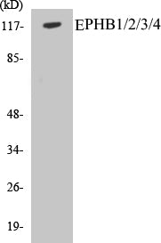 Western blot analysis of extracts from NIH-3T3 cells, treated with heat shock, using EPHB1/2/3/4 (Ab-600/602/614/596) Antibody.