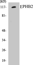 Western blot analysis of extracts from Jurkat cells, using EPHB2 Antibody.