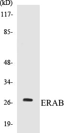Western blot analysis of extracts from LOVO cells, using ERAB Antibody.