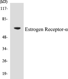 Western blot analysis of extracts from 293 cells, treated with Forskolin, using Estrogen Receptor-alpha (Ab-104) Antibody.