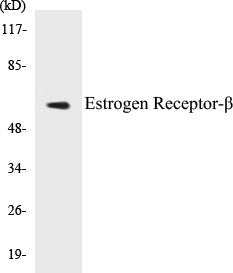 Western blot analysis of extracts from HeLa cells, treated with EGF 200ng/ml 30', using Estrogen Receptor-beta (Ab-105) Antibody.