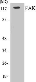 Western blot analysis of extracts from MCF-7/HuvEc cells, using FAK (Ab-843) Antibody.