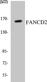 Western blot analysis of extracts from HT-29 cells, treated with Calyculin A 50ng/ml 30', using FANCD2 (Ab-222) Antibody.