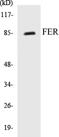 Western blot analysis of extracts from HeLa cells treated with paclitaxel 1uM 24h, using FER (Ab-402) Antibody.