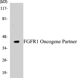 Western blot analysis of extracts from HepG2 cells, using FGFR1 Oncogene Partner Antibody.