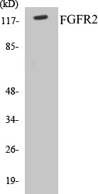Western blot analysis of extracts from A549 cells, using FGFR2 Antibody.