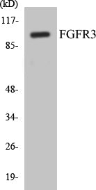 Western blot analysis of extracts from LOVO cells, using FGFR3 Antibody.