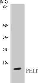 Western blot analysis of extracts from A549 cells, using FHIT Antibody.