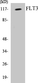 Western blot analysis of extracts from LOVO cells, using FLT3 (Ab-599) Antibody.