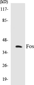 Western blot analysis of extracts from RAW264.7 cells, using FOS (Ab-32) Antibody.