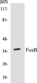 Western blot analysis of extracts from COS7/Jurkat cells, using FosB (Ab-27) Antibody.