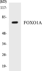 Western blot analysis of extracts from HeLa cells, treated with Serum 20% 15', using FOXO1A (Ab-329) Antibody.