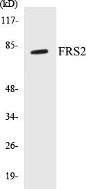 Western blot analysis of extracts from HepG2 cells, using FRS2 (Ab-196) Antibody.