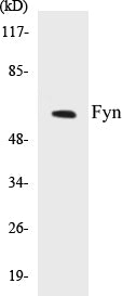Western blot analysis of extracts from MCF-7/293 cells, using Fyn (Ab-530) Antibody.